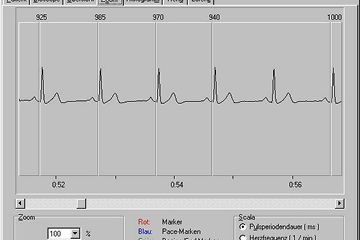 EKG-Zoom