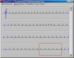EKG-Übersicht